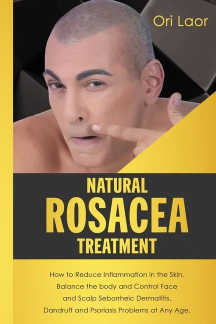 Natural Rosacea Treatment: How to Reduce Inflammation in the Skin, Balance the body and Control Face and Scalp Seborrheic Dermatitis, Dandruff an - Paperback