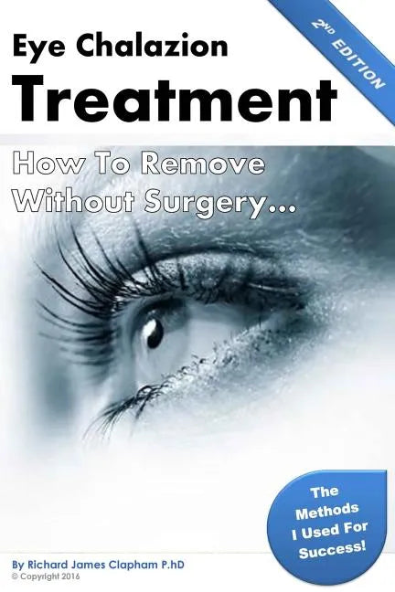 Eye Chalazion: How To Remove Without Surgery: My personal experience and the methods I used for success - Paperback