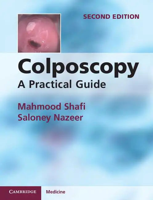 Colposcopy - Paperback