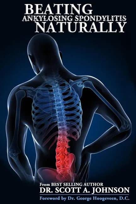 Beating Ankylosing Spondylitis Naturally - Paperback