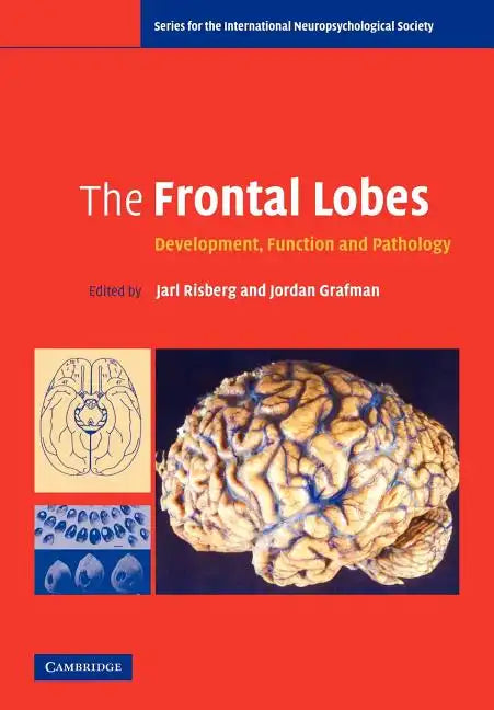 The Frontal Lobes - Paperback