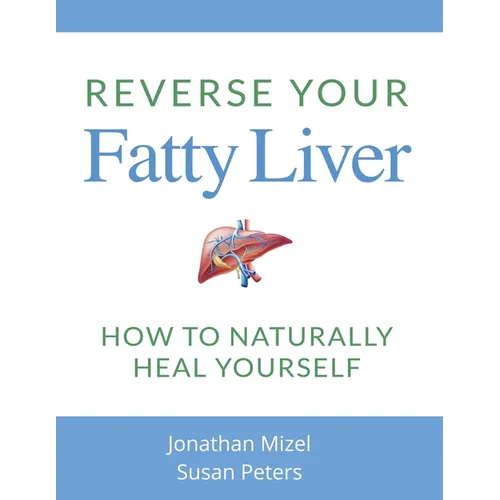 Reverse Your Fatty Liver: How To Naturally Heal Yourself - Paperback