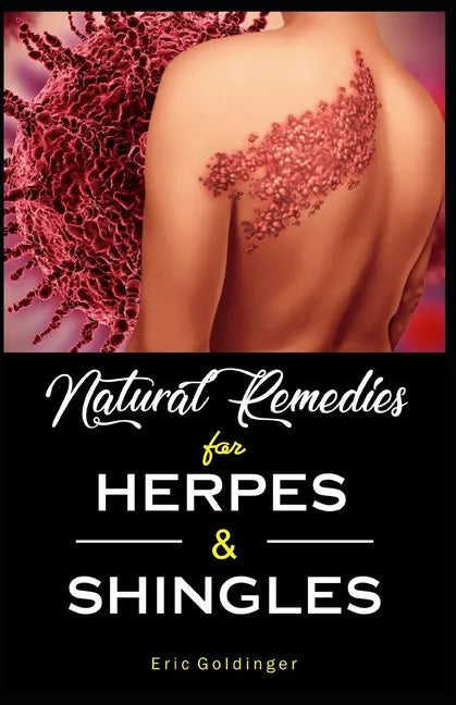 Natural Remedies For HERPES & SHINGLES: The Complete Guide - Paperback