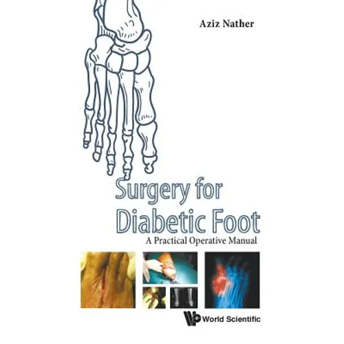 Surgery for Diabetic Foot - Hardcover