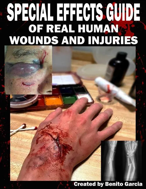 Special Effects Guide Of Real Human Wounds and Injuries: Special Effects Guide Of Real Human Wounds and Injuries - Paperback
