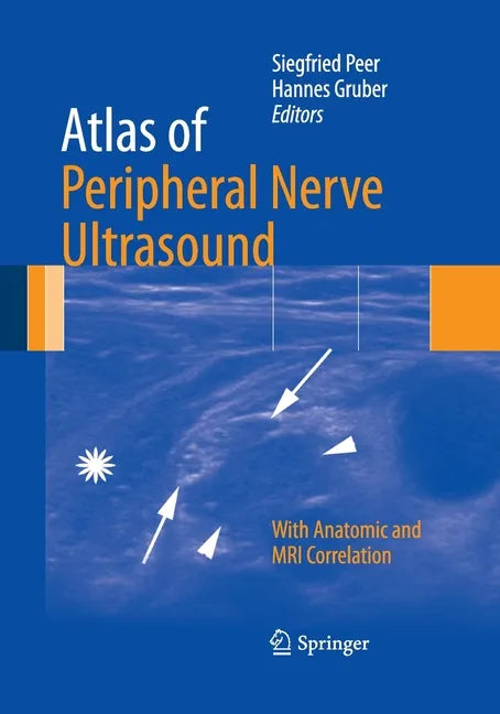 Atlas of Peripheral Nerve Ultrasound: With Anatomic and MRI Correlation - Paperback