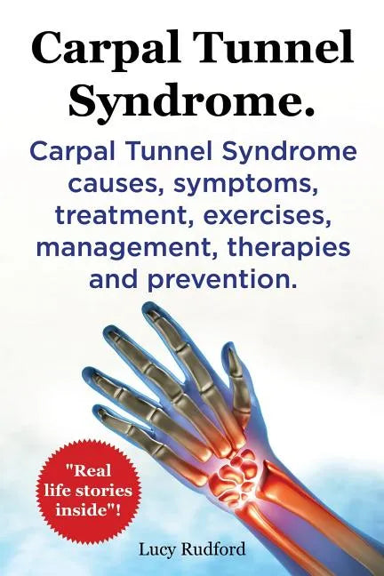 Carpal Tunnel Syndrome, Cts. Carpal Tunnel Syndrome Cts Causes, Symptoms, Treatment, Exercises, Management, Therapies and Prevention. - Paperback