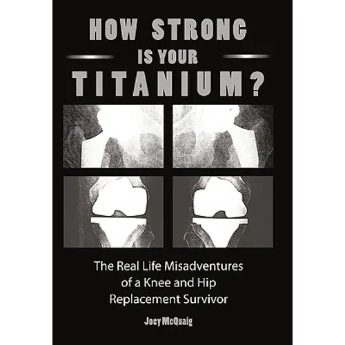 How Strong Is Your Titanium: The Real Life Misadventures of a Knee and Hip Replacement Survivor - Paperback