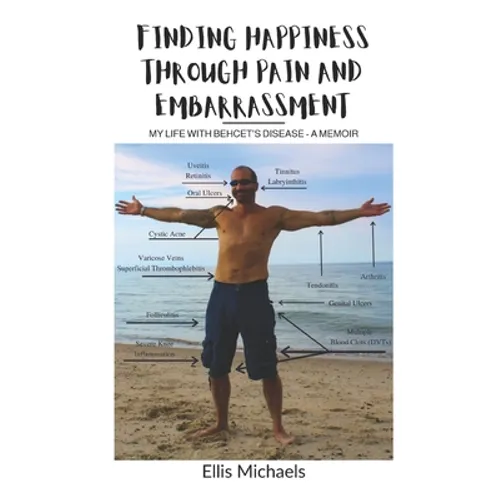Finding Happiness Through Pain and Embarrassment: My Life With Behcet's Disease - A Memoir - Paperback