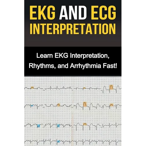 EKG and ECG Interpretation: Learn EKG Interpretation, Rhythms, and Arrhythmia Fast! - Paperback