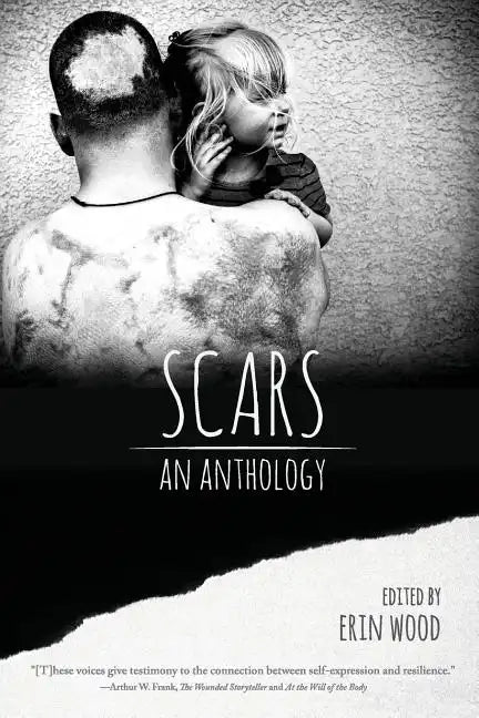 Scars: An Anthology - Paperback