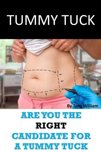 Tummy Tuck: Are You The Right Candidate For A Tummy Tuck - Paperback