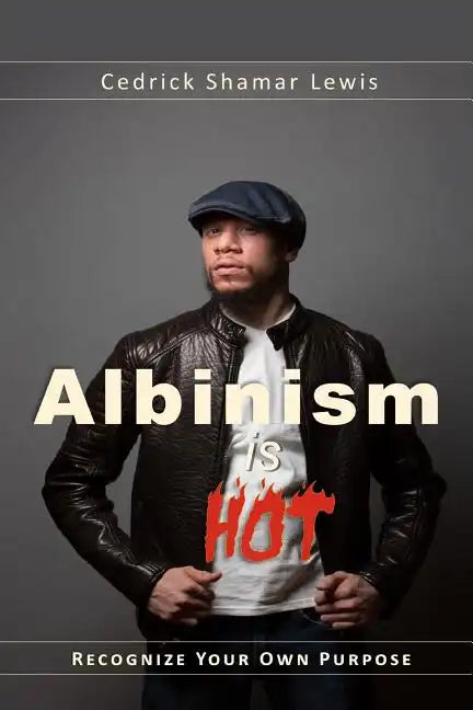 Albinism is Hot! - Paperback