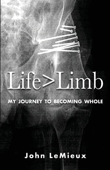Life is Greater Than Limb: My Journey to Becoming Whole - Paperback