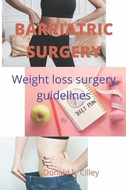 Barriatric Surgery: Weight loss surgery guidelines - Paperback