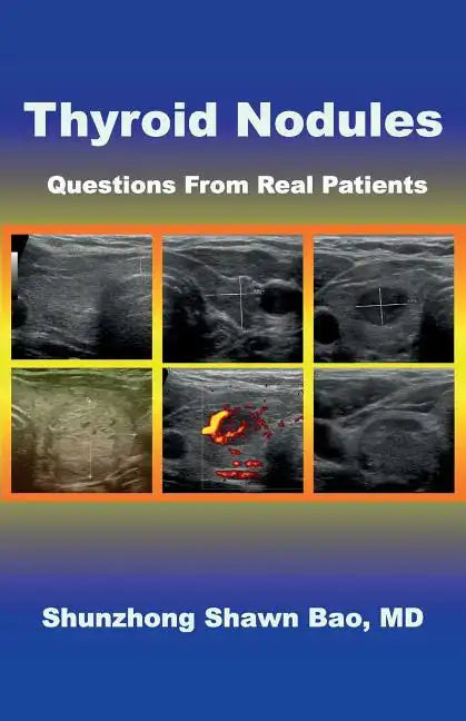 Thyroid Nodules: Questions From Real Patients - Paperback