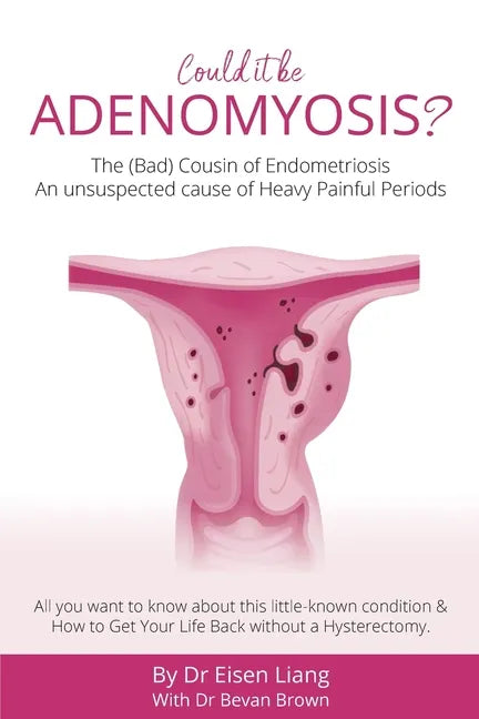 Adenomyosis -The Bad Cousin of Endometriosis: An unsuspected cause of Heavy Painful Periods - Paperback