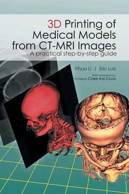 3D Printing of Medical Models from CT-MRI Images: A Practical step-by-step guide - Paperback
