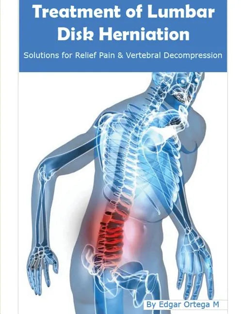 Treatment of Lumbar Disk Herniation: Back Pain Relief and Herniated Discs Solutions - Paperback