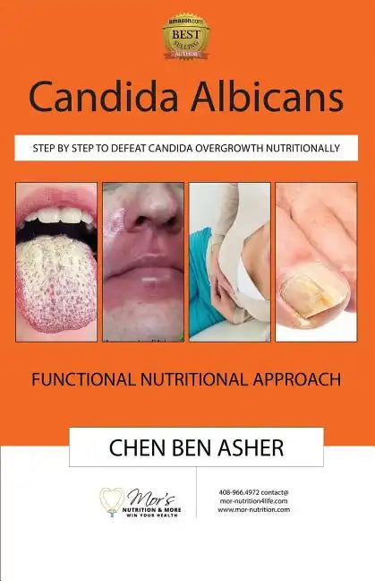 Candida Albicans: Step by Step to Defeat Candida Overgrowth Nutritionally - Paperback