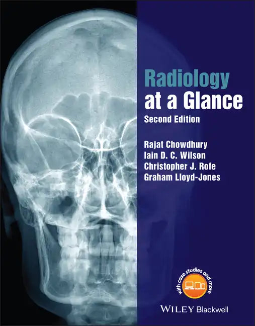 Radiology at a Glance - Paperback
