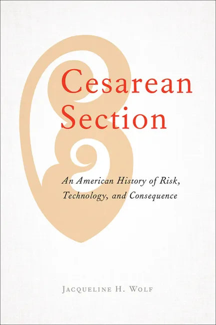 Cesarean Section: An American History of Risk, Technology, and Consequence - Paperback