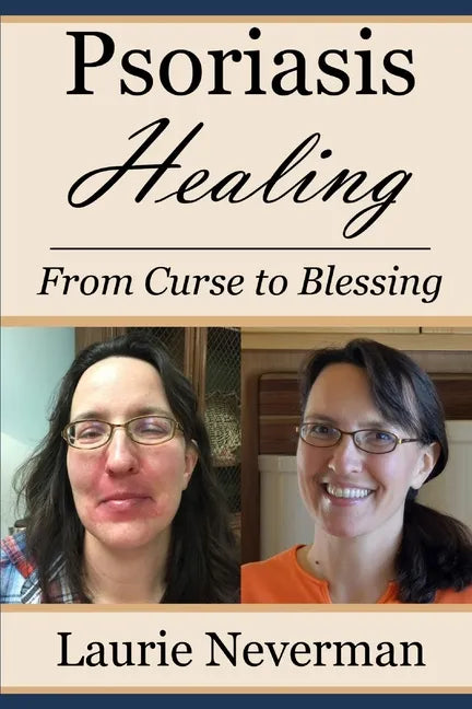 Psoriasis Healing: From Curse to Blessing - Paperback