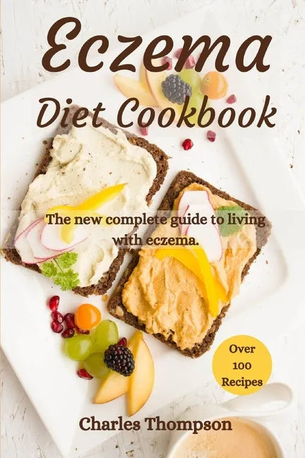 Eczema Diet Cookbook: The new complete guide to living with eczema. More than 100 recipes against the symptoms of dermatitis and psoriasis. - Paperback