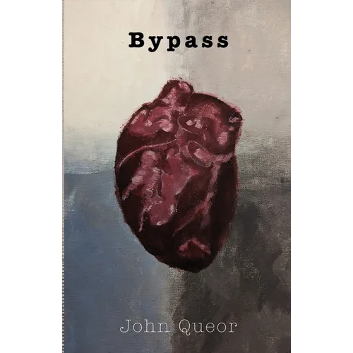 Bypass - Paperback