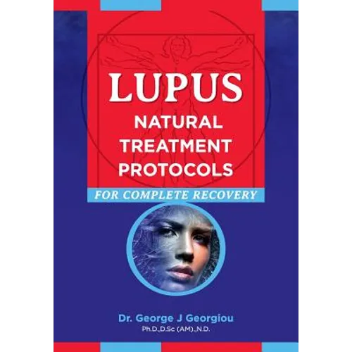Lupus: Natural Treatment Protocols for Complete Recovery - Paperback
