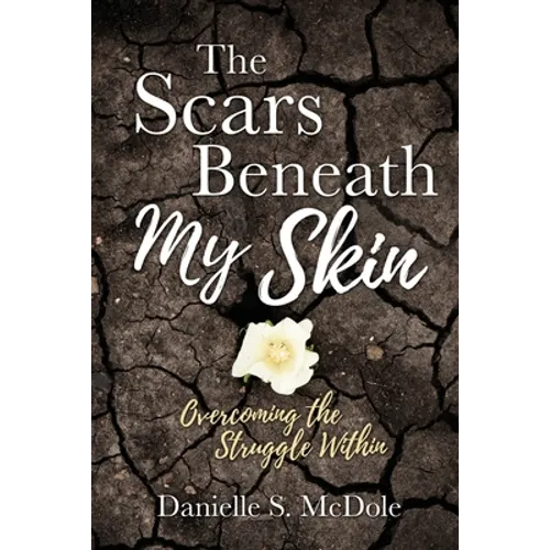 The Scars Beneath My Skin: Overcoming the Struggle Within - Paperback