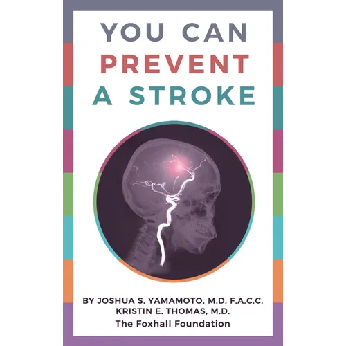 You Can Prevent a Stroke - Paperback