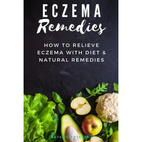 Eczema Remedies: How to Relieve Eczema With Diet & Natural Remedies - Paperback