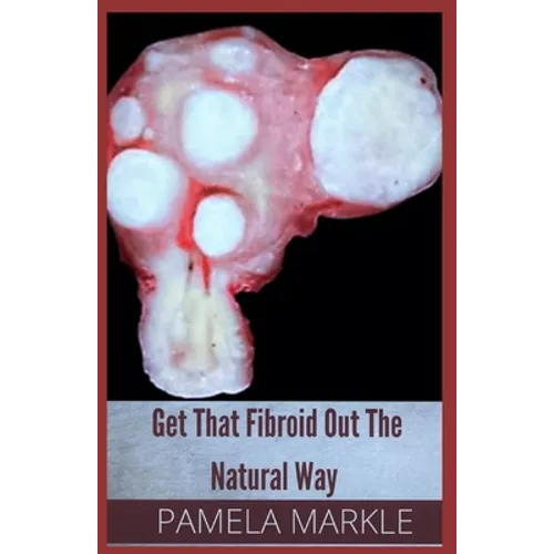 Get That Fibroid Out the Natural Way - Paperback