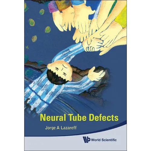 Neural Tube Defects - Hardcover