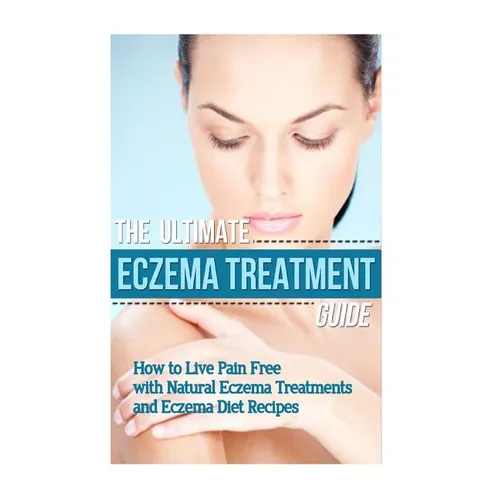 The Ultimate Eczema Treatment Guide: How to Live Pain Free with Natural Eczema Treatments and Eczema Diet Recipes - Paperback