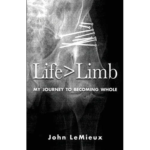 Life is Greater Than Limb: My Journey to Becoming Whole - Paperback