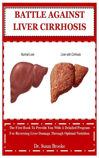Battle Against Liver Cirrhosis: The First Book To Provide You With A Detailed Program For Reversing Liver Damage Through Optimal Nutrition - Paperback