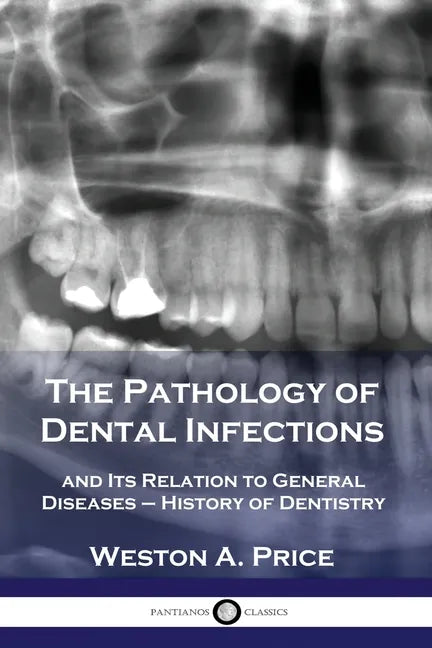 The Pathology of Dental Infections: and Its Relation to General Diseases - History of Dentistry - Paperback