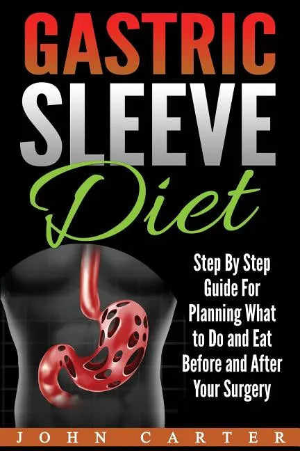 Gastric Sleeve Diet: Step By Step Guide For Planning What to Do and Eat Before and After Your Surgery - Paperback