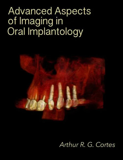Advanced Aspects of Imaging in Oral Implantology - Paperback