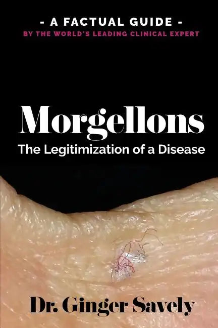 Morgellons: The legitimization of a disease: A Factual Guide by the World's Leading Clinical Expert - Paperback