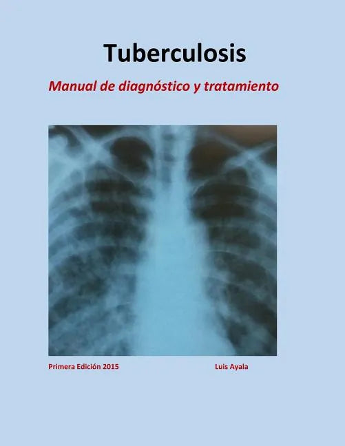 Tratamiento de Tuberculosis: Manual de diagnóstico y tratamiento - Paperback