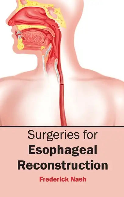 Surgeries for Esophageal Reconstruction - Hardcover