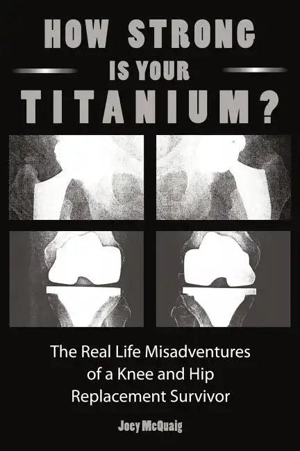 How Strong Is Your Titanium: The Real Life Misadventures of a Knee and Hip Replacement Survivor - Paperback
