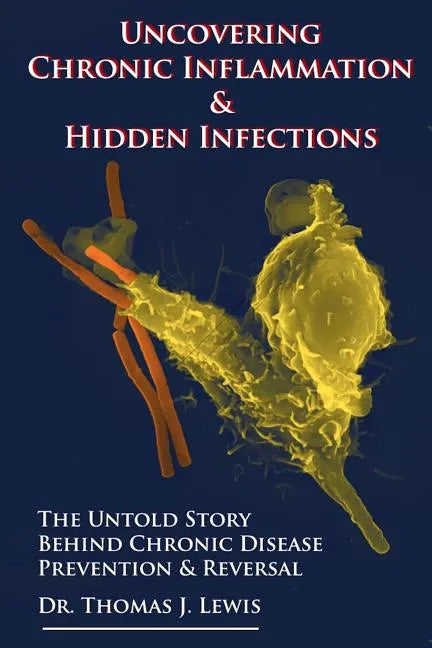 Uncovering Chronic Inflammation & Hidden Infections: The Untold Story Behind Chronic Disease Prevention & Reversal - Paperback