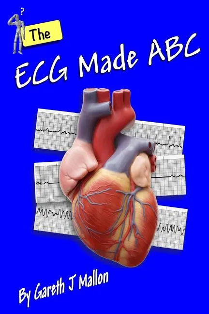 The ECG Made ABC - Paperback