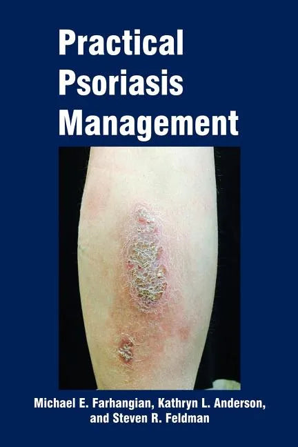 Practical Psoriasis Management - Paperback