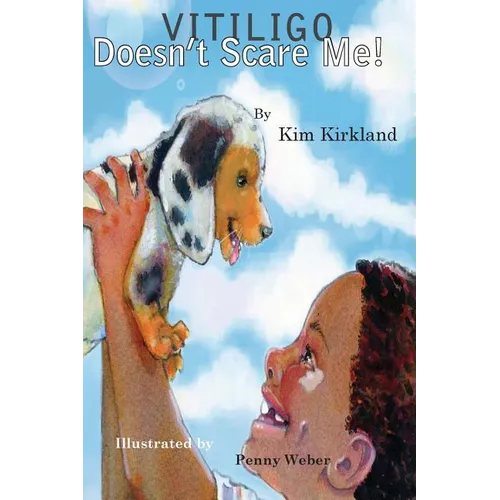 Vitiligo Doesn't Scare Me - Paperback