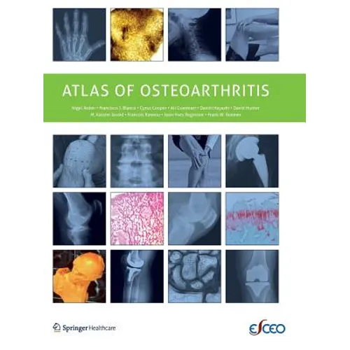 Atlas of Osteoarthritis - Paperback